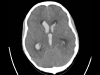 ct_kopf_10