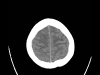 ct_kopf_21