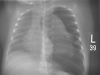 Thorax
