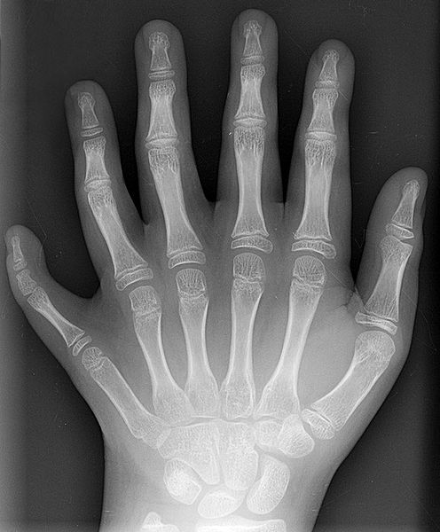 olydactylLhand_AP