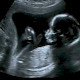 Schwangerschaft und Strahlenschutz des Ungeborenen