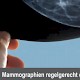 Mammographien regelrecht erstellen