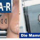 Die Mammographie - digit. Nachbearbeitung