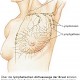 Sentinel-Lymph-Nodes beim Mammakarzinom (Teil 2)