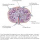 Sentinel-Lymph-Nodes beim Mammakarzinom (Teil 1)