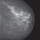 Kriterien für regelgerechte Mammographien