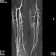 Die Angiographie von 1896 bis heute