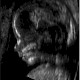 Dürfen schwangere MTRA, MFA und Ärztinnen röntgen?