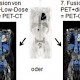 PET-CT mittels 18-FDG (Fluordesoxyglucose)