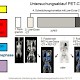 PET-CT mittels 18-FDG (Fluordesoxyglucose)
