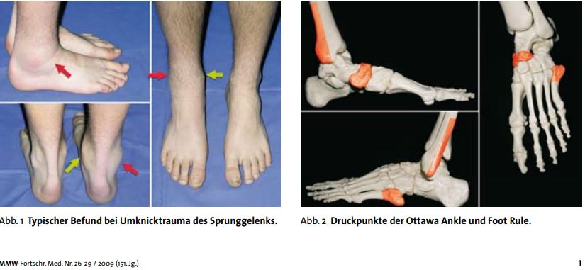 Knöchel dicker fuß umgeknickt Wie wird