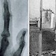 Erforschung eines historischen Röntgengerätes