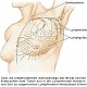 Die Mammographie (Teil 1)