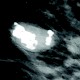 Die Mammographie (Teil 1)