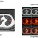 Das PET-CT