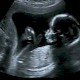 Ist Ultraschall in der Schwangerschaft gefährlich?